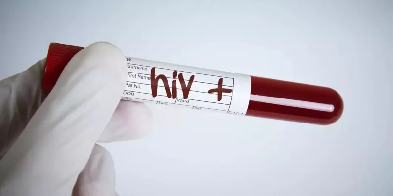 AIDS Belirtileri