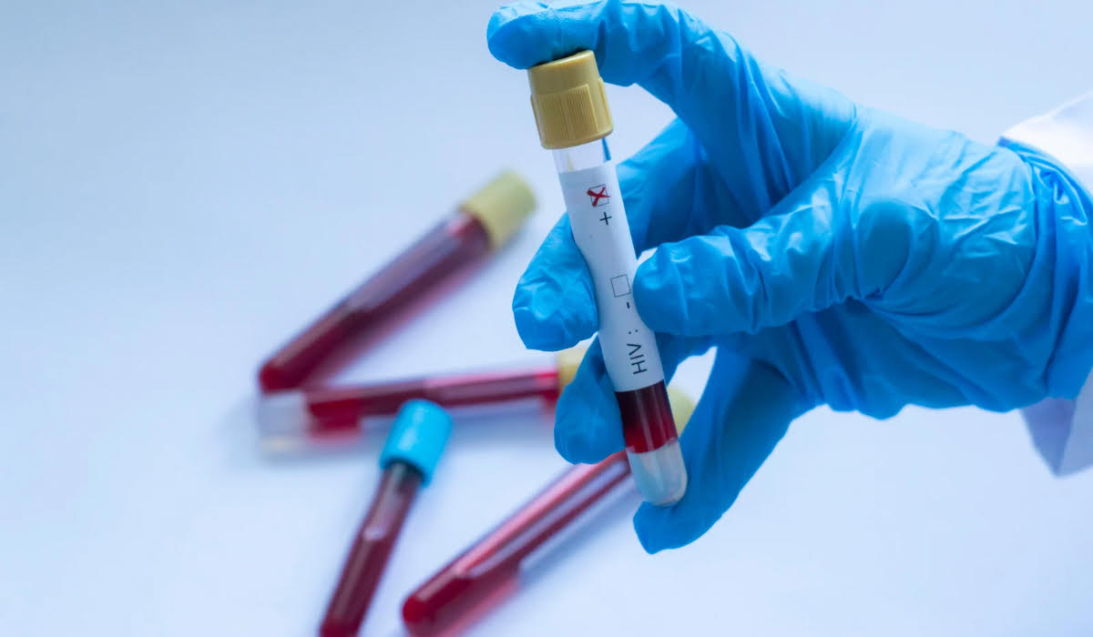 HIV/AIDS Testi Fiyatları