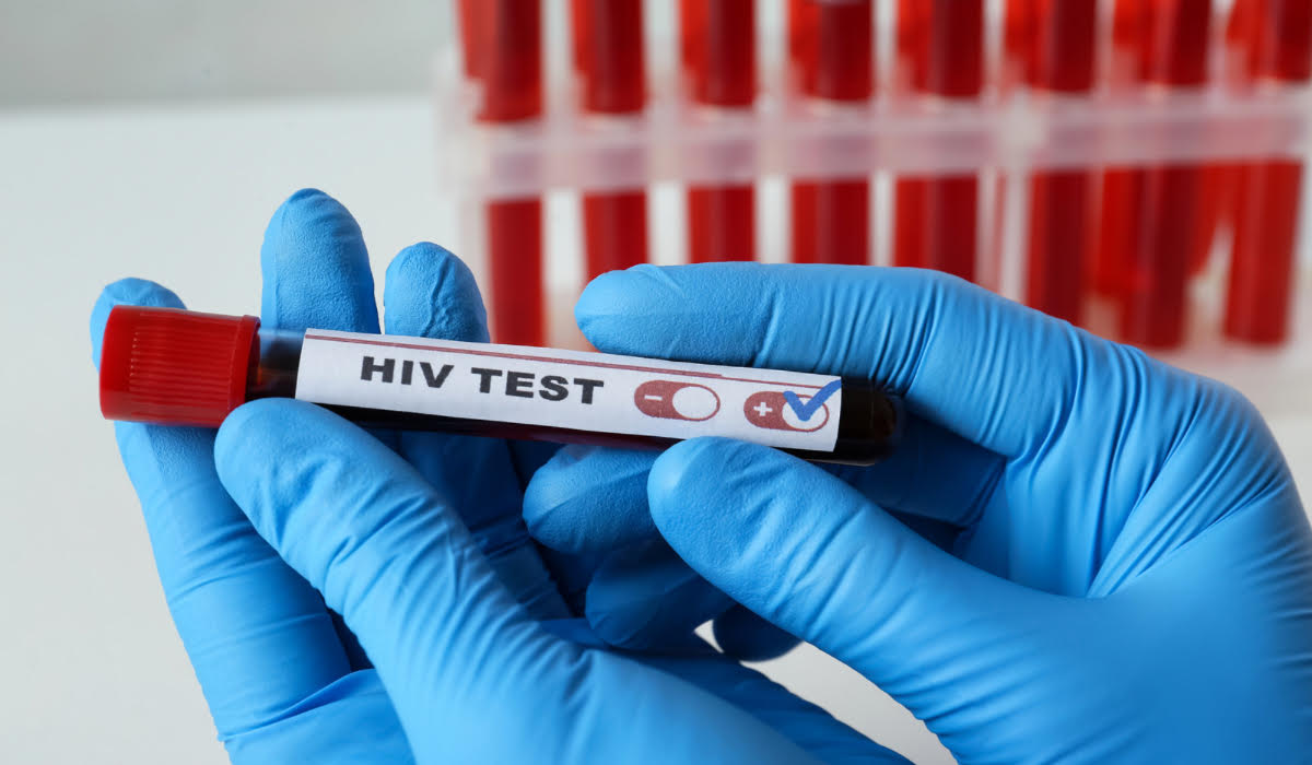 HIV/AIDS Testi