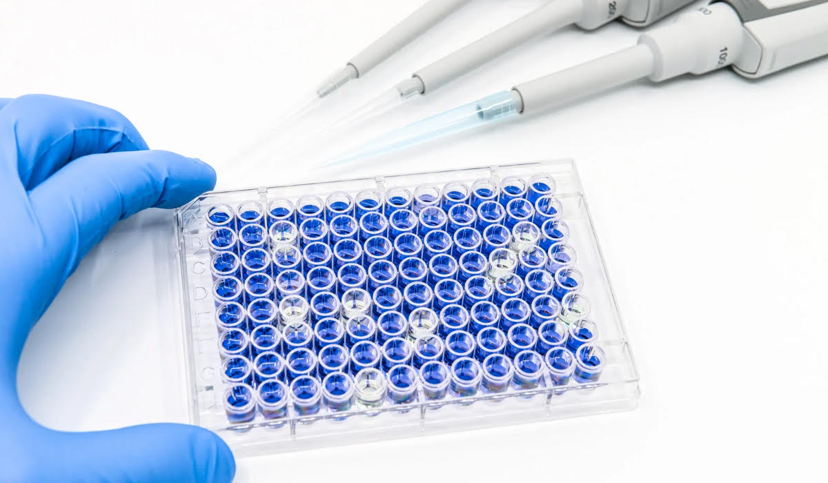 Elisa Testi Nedir? Nasıl Yapılır?