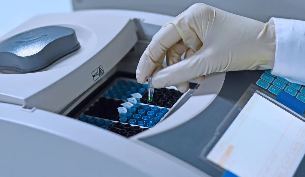 HIV PCR Testi Nedir?
