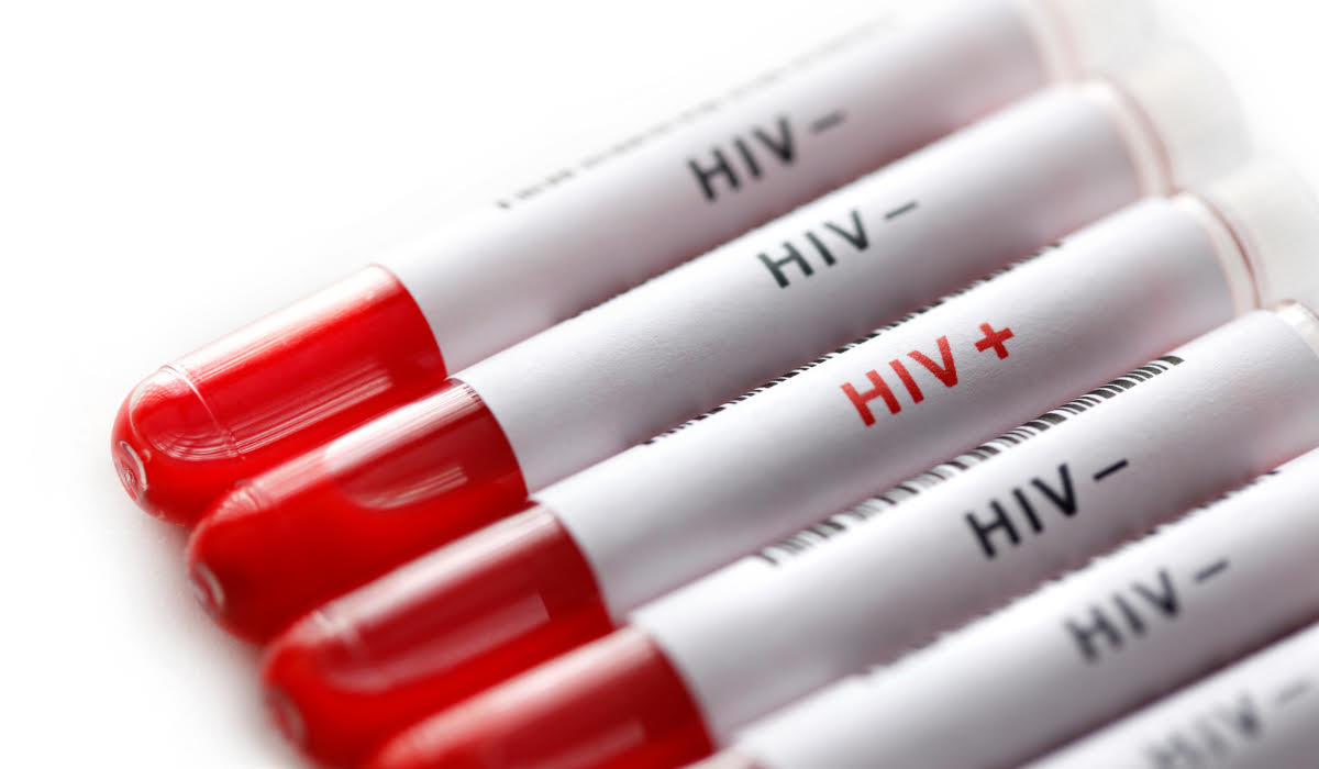 HIV Duo Ultra Testi