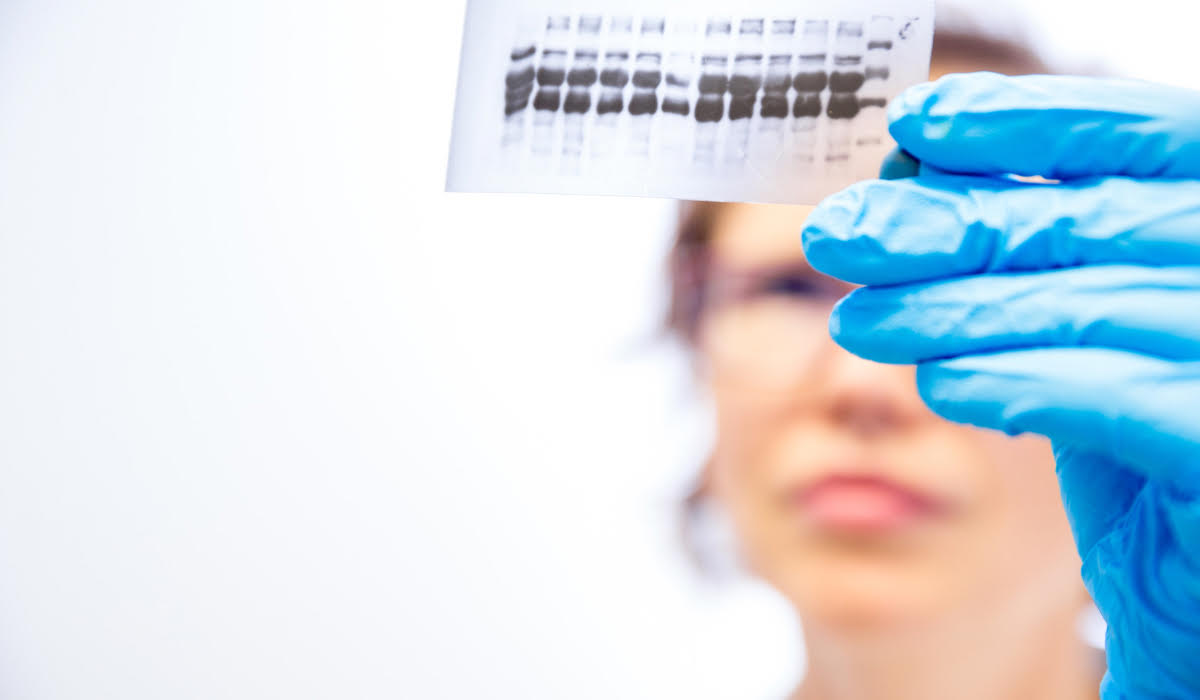 Western Blot Testi Nedir? Nasıl Yapılır?